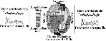 Ce este încetarea ca urmare a voinței unilaterale a uneia dintre părți? Harta Regiunilor Cerebrale Prospectate Din Punct De Vedere Al Download Scientific Diagram