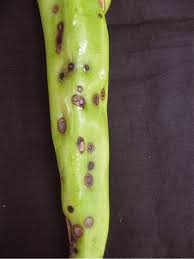 The black spots on your aloe vera usually referred to as leaf spot, are caused by a pathogen known as the alternaria alternata. Aloe Vera Brown Spots On Aloe Vera Plant