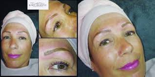 However, the rest of my body hair pretty much disappeared after second cycle including eyebrow and eyelash hair which was the worst. Would You Consider Microblading For Chemo Eyebrow Hair Loss Suburban Turban