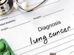 A sample of sputum (mucus you cough up from the lungs) is looked at in the lab to see if it has cancer cells. Early Detection Key To Check Lung Cancer Deccan Herald