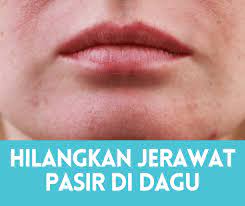 Check spelling or type a new query. Cara Menghilangkan Jerawat Pasir Di Dahi Dagu Pipi Sihat Me