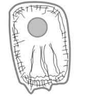 In locations where a hemidesmosome's attentions are unrequited, such as the junction of an epithelial cell with its basement membrane, hemidesmosomes appear alone. 1 Indicate Which Type Of Cytoskeletal Fiber Is Chegg Com