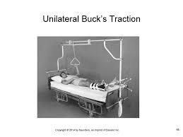 Applying bucks traction for femur fractures and how to educate families on use. Lafleur Brooks Health Unit Coordinating Ppt Download