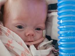 Fundraiser by Emily Atkinson : Help with Isla's Medical Care