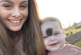 Przyszła na świat z nietypowym znamieniem. Przeszła operacje. 'Najcięższa  decyzja w życiu'