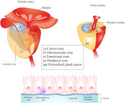 Image result for Expressed Prostatic Secretion