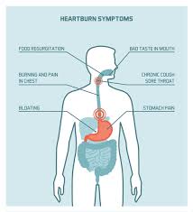 Maybe you would like to learn more about one of these? Gerd Symptoms Causes And Treatment In Cape Town Gastroenterologist In Cape Town Dr Deetlefs