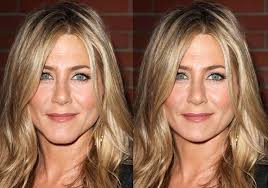 Jennifer Aniston Plastic Surgery Jennifer Aniston Before And After Chin Surgery Jennifer Aniston Plastic Surgery Facial Feminization Surgery Jennifer Aniston
