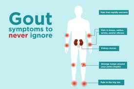 Pin On Gout Attack