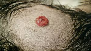 Cancer in dogs is prevalent; Hemangiosarcoma In Dogs Everything Dog Owners Should Know