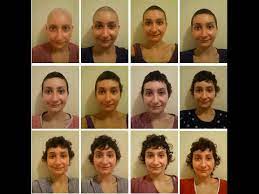 You can expect to regrow your hair three to six months after your treatment ends, though your hair may temporarily be a different shade or texture. Hair Growth After Cancer 3 Years Without A Haircut Youtube