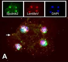 Scientists worry whether russia's 'sputnik v' coronavirus vaccine is safe and effective published tue, aug 11 2020 1:34 pm edt updated tue, aug 11 2020 2:45 pm edt berkeley lovelace jr. Virus Inception Virus Found Inside A Virus Inside A Virus Inside An Amoeba On A Woman S Eye