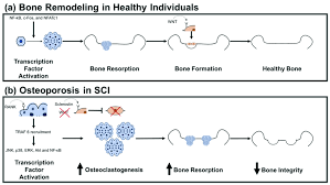 Most backbone application examples that you find on the web are very small and very simple. Typical Bone Remodeling Vs Bone Remodeling In Individuals With Spinal Download Scientific Diagram