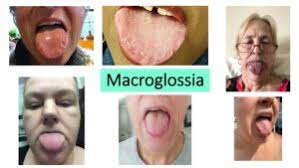 Image result for Isoglossa namuliensis