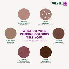 Effective ways to get rid of hickeys. What Do Your Cupping Colours Tell You Thomson Chinese Medicine