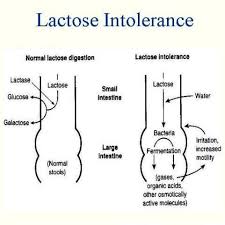 We did not find results for: If Testing Shows You Are Lactose Intolerant Make A Plan With Your Physician Or Nutritionist To Ensu Lactose Intolerant Symptoms Intolerance Lactose Intolerant
