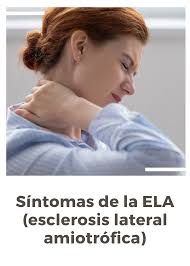 La esclerosis lateral amiotrófica es una enfermedad que causa pérdida progresiva de la fuerza y atrofia de los músculos, llevando a la muerte en cerca en este artículo vamos a explicar lo que es la esclerosis lateral amiotrófica, cuáles son sus causas y factores de riesgo, sus síntomas, cómo se. Sintomas De La Ela Esclerosis Lateral Amiotrofica Esclerosis Lateral Esclerosis Lateral Amiotrofica Esclerosis