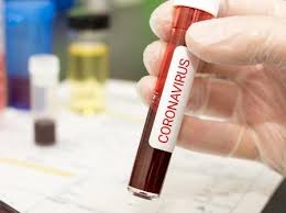 Coronavirus Policia De Sc Investiga Venda De Testes Em Redes Sociais