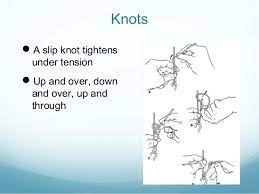 What is bone fracture realignment?.maximum weight that vmcan be applied. Application Of Traction In Orthopaedics