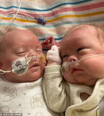 Father of UK's most premature twins says 'every day is Father's Day'