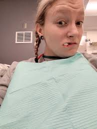 Update Susan is out of surgery. Everything went great. Two plates upper and  two plates lower. They didn't need to mess with the septum in the nose, as  it shifted back with