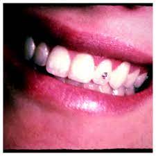 How old do i have to be to get a tooth gem? 24 Do It Yourself Tooth Gem Kit Ideas Tooth Gem Teeth Jewelry Gems