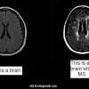 It on mri presents as a large. 1