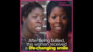 The front teeth sheer off whatever the. Woman Bullied For Teeth Gets New Smile For Free Heartthreads Youtube