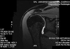 Image result for Shoulder Imaging