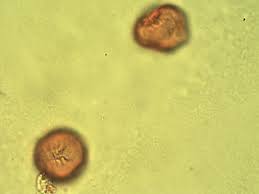 Image result for Alchornea laxiflora