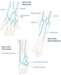 Image result for Peripheral IV Access