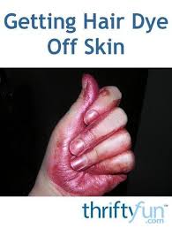 Getting Hair Dye Off Skin In 2020 Hair Dye Removal Dyed Hair Dyed Hair Blue