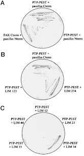 Categories:bee control & removal services, pest control information & referral services, pest control services, pest control services commercial & industrial, termite. The Noncatalytic Domain Of Protein Tyrosine Phosphatase Pest Targets Paxillin For Dephosphorylation In Vivo Journal Of Biological Chemistry