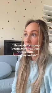 Sagittal Craniosynostosis Surgery