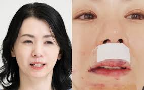 ピューッと顔から出血、「くちびるが3倍」に膨れ上がっただけじゃ ...