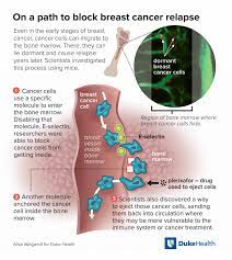 Cancer S Spread To Bone National Cancer Institute