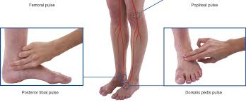 Https Pre Med Jumedicine Com Wp Content Uploads Sites 7 2019 02 Clinical Notes On Lower Limb Anatomy Pdf