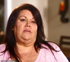 Woman who has ten large cysts