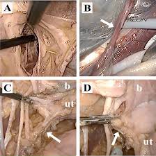 New album edder & bile out now! Laparoscopic Appearances Of Thiel Embalmed Human Cadavers A Opening Download Scientific Diagram