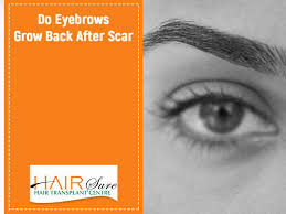 How to get thicker eyebrows: Do Eyebrows Grow Back After Scar Hair Sure
