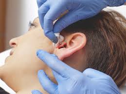 Check spelling or type a new query. Can You Get A Tragus Piercing For Migraine Relief