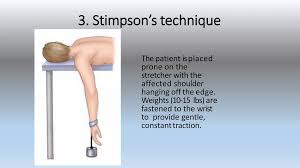 Image result for Shoulder Relocation Maneuvers