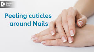 We did not find results for: What To Do For Peeling Cuticles Around Nails Dr Rasya Dixit Doctors Circle Youtube
