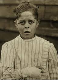 Accident to young mill worker. Giles Edmund Newsom while working in Sanders  Spinning Mille, Bessemer City N.C., August 21 st, 1912, a piece of the  machine fell