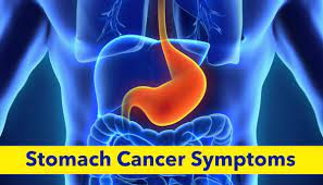 Symptoms of stomach cancer can diagnose the disease of the gastrointestinal tract and start the necessary treatment on time. Stomach Cancer Symptoms Best Gastro Surgeon Ahmedabad Best Gatroenterologist Ahmedabad Best Liver Surgeon Ahmedabad Liver Surgery Ahmedabad Best Liver Surgeon Ahmedabad Weight Loss Clinic Ahmedabad Best Weight Loss Clinic Ahmedabad Best