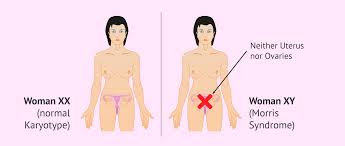 We did not find results for: Morris Syndrome Characteristics Causes And Reproductive Options