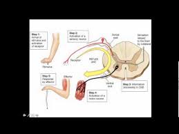 Image result for Neurologic Lesion Localization