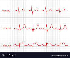 Heart Cardiogram Charts Set Healthy Heart