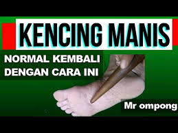 We did not find results for: Cara Menormalkan Sakit Kencing Manis Diabetes Hanya Dengan Pijat Refleksi Youtube