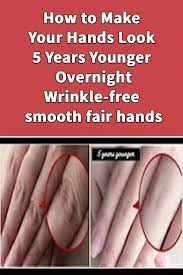 When visting heal my hands enter: How To Make Your Hands Look 5 Years Younger Overnight Wrinkle Free Smooth Fair Hands Skin Care Wrinkles Wrinkles Hands Beauty Skin Care Routine